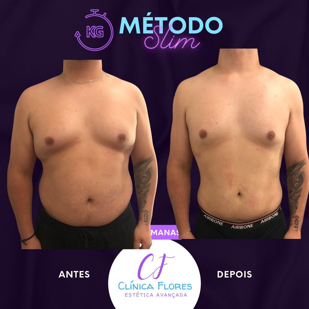 Método Slim — Masculino